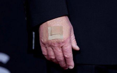 Nhà Trắng lý giải miếng băng dán trên tay Tổng thống Trump